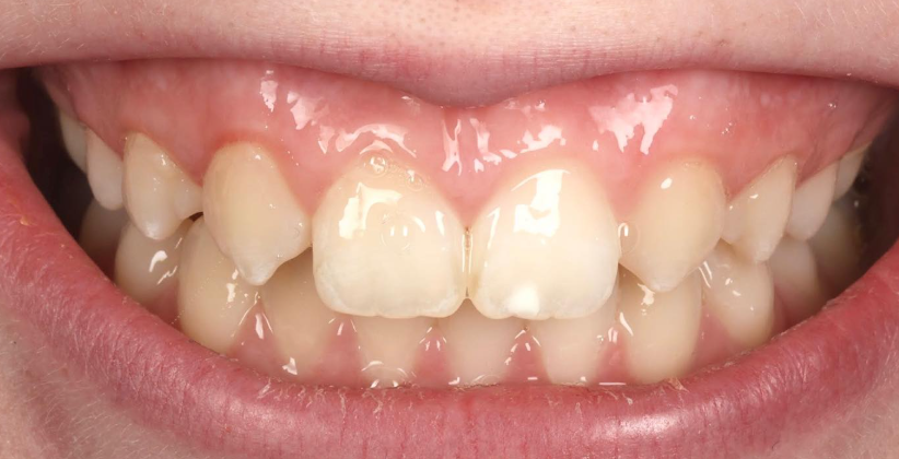 Case 2 before treatment