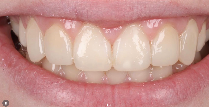 Case 2 after treatment