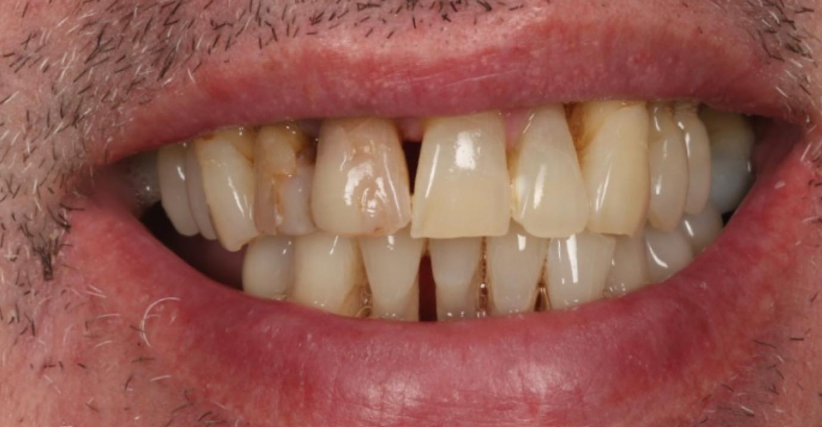 Case 3 before treatment